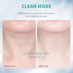 Neck Beauty Device
