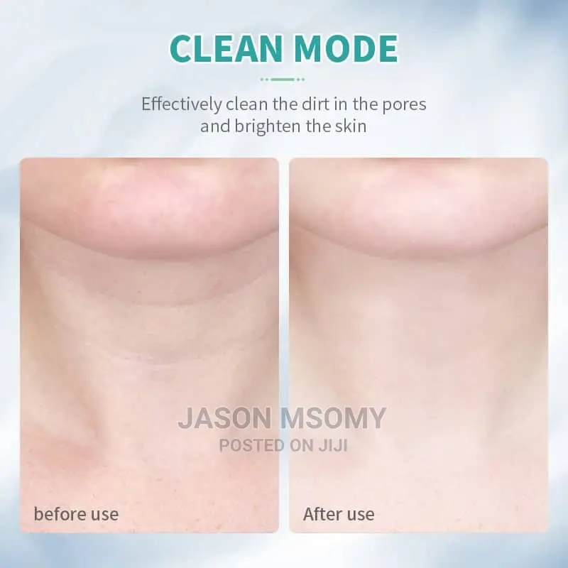 Neck Beauty Device