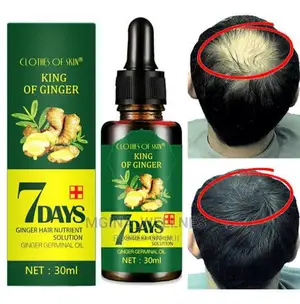 7 Days Ginger Hair Growth