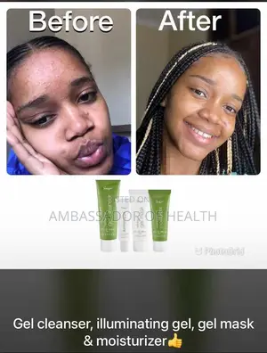 Gel Cleanser Inarudisha Muonekano Wa Ngozi Yako Usoni