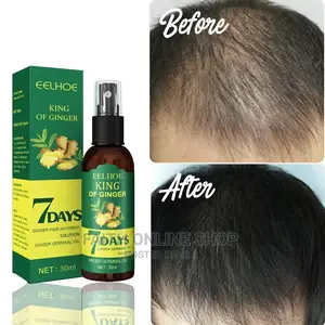 7day Ginger Hair Growth 30ml