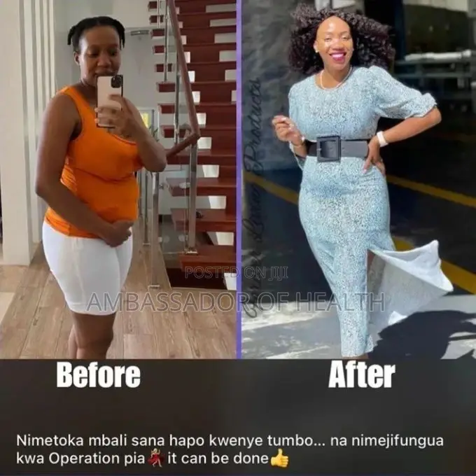 Punguza Tumbo Tuu Uwe Na Muonekano Wa Kuvutia Zaidi