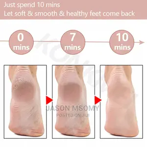 Electric Peeling Pedicure