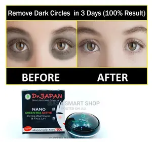 Dr.JAPAN Skin Lightening Complex.(Ondoa Madoa Usoni)
