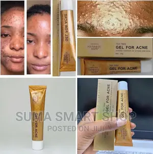 KENNITE Acne Gel . (Futa Chunusi ) .
