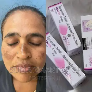 SKINLITE Creame. ( Melasma Treatment )