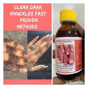 CLEAR DARK Knuckles .(Futa SUGU Kwa Kuosha ).