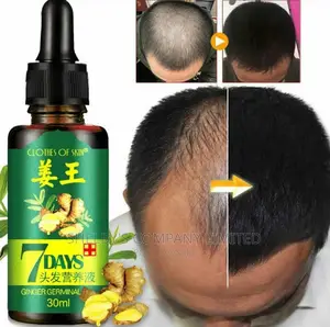 Ginger Hair Growth Solution