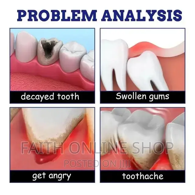 Toothache Relief Spray