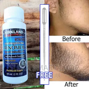 MINOXIDIL Grow Your BEARD.(Kuza Ndevu Zako) .