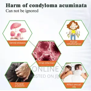 Genital Wart Remover Cream