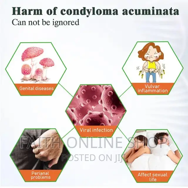 Genital Wart Remover Cream
