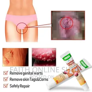Genital Wart Remover Cream