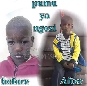 Pumu Ya Ngozi