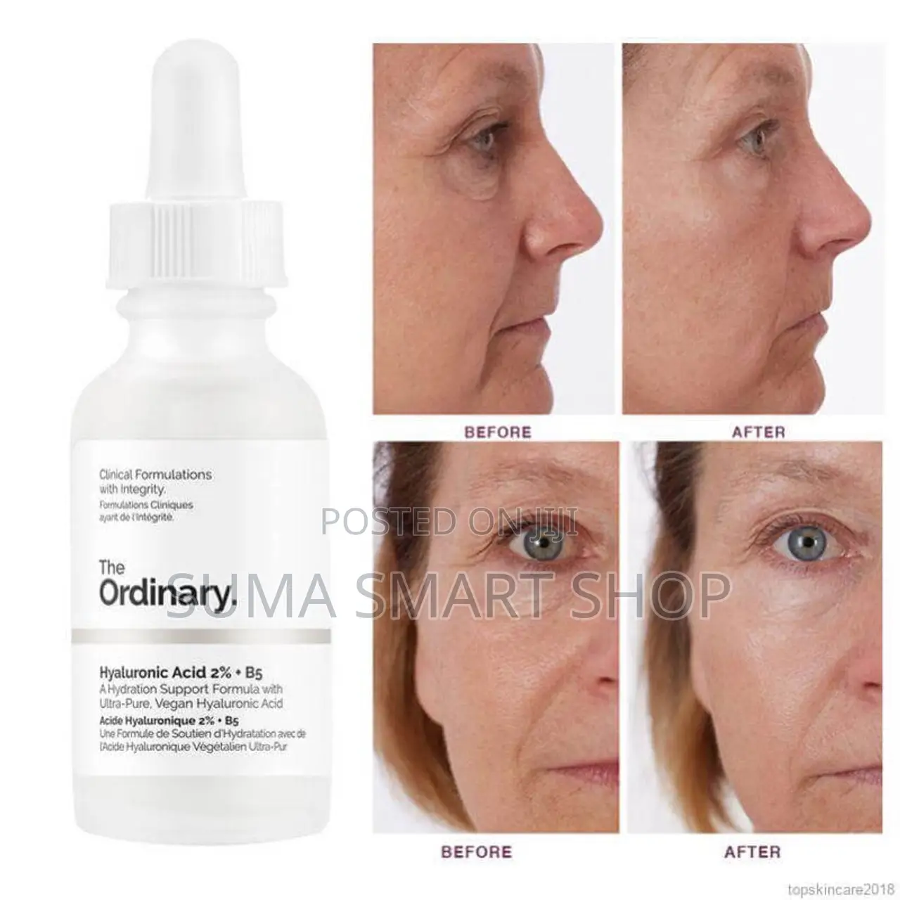 The ORDINARY Hyaluronic Acid 2%+B5 Serum.(Ondoa Mikunjousoni