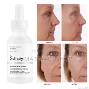 The ORDINARY Hyaluronic Acid 2%+B5 Serum.(Ondoa Mikunjousoni