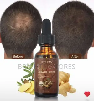 Hair Growth