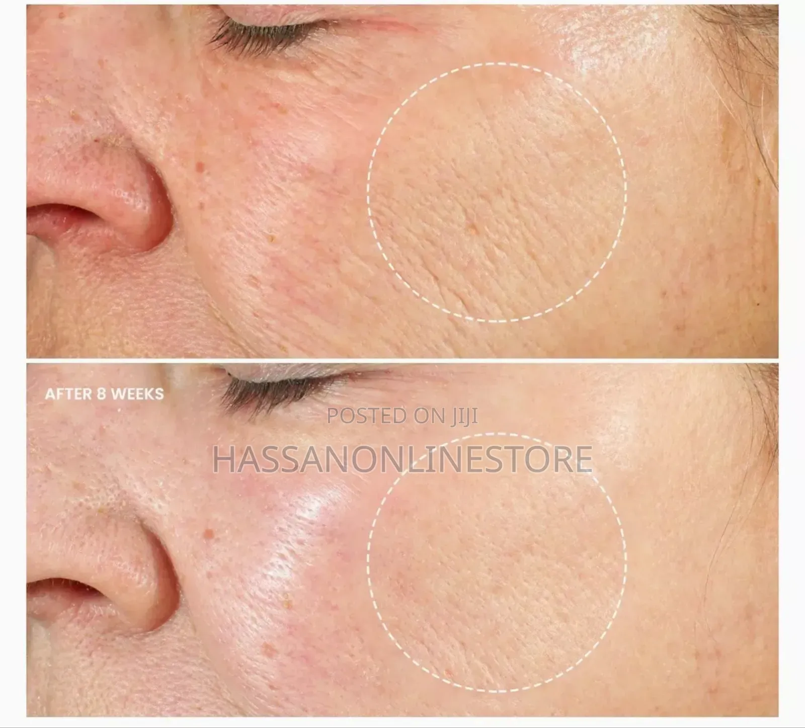 The Ordinary Aha 30% Bha 2% Peeling Solution