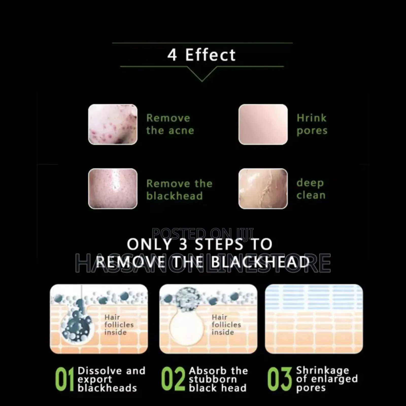 Dexe Acne Purifying Peel Off Mask 120g