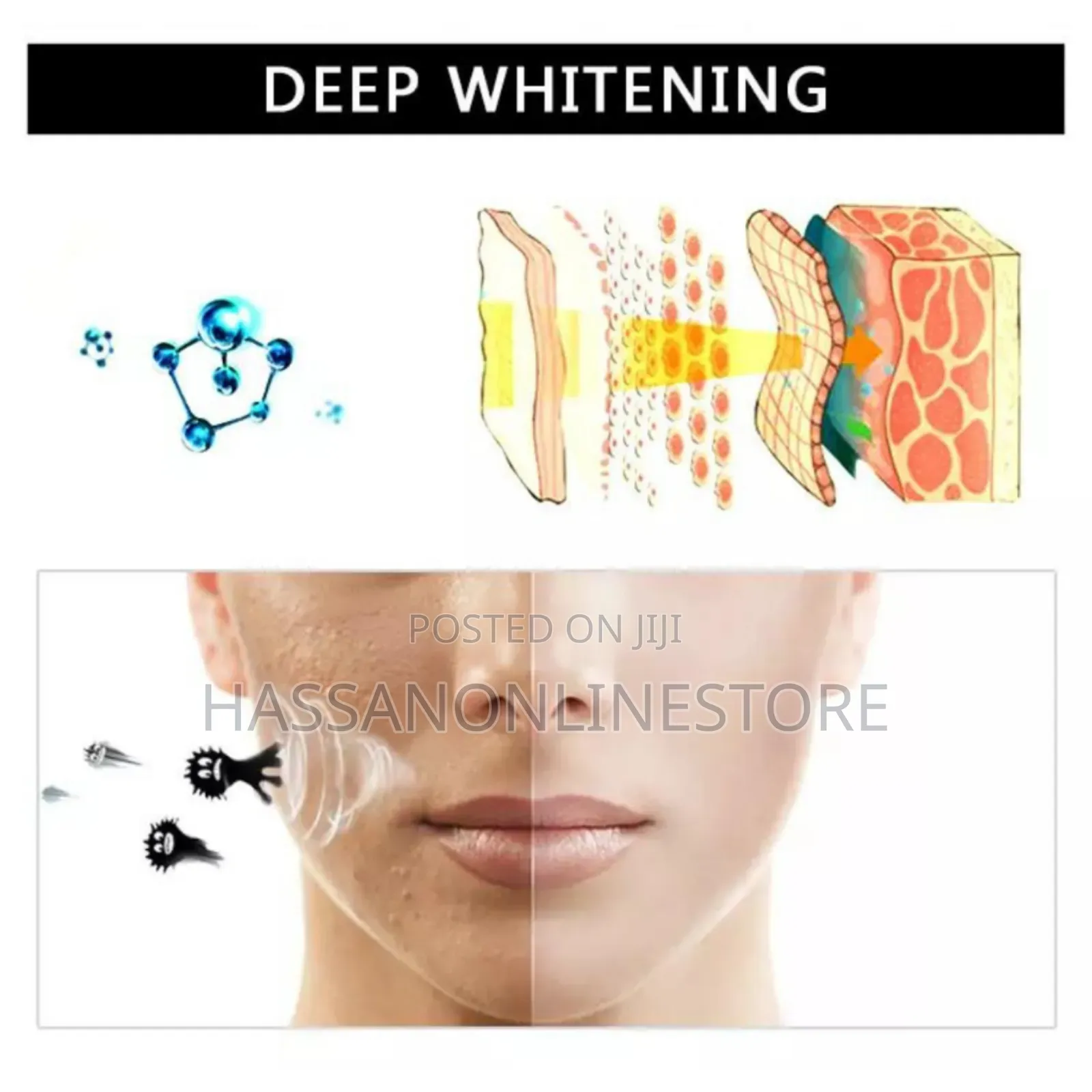 Dexe Acne Purifying Peel Off Mask 120g