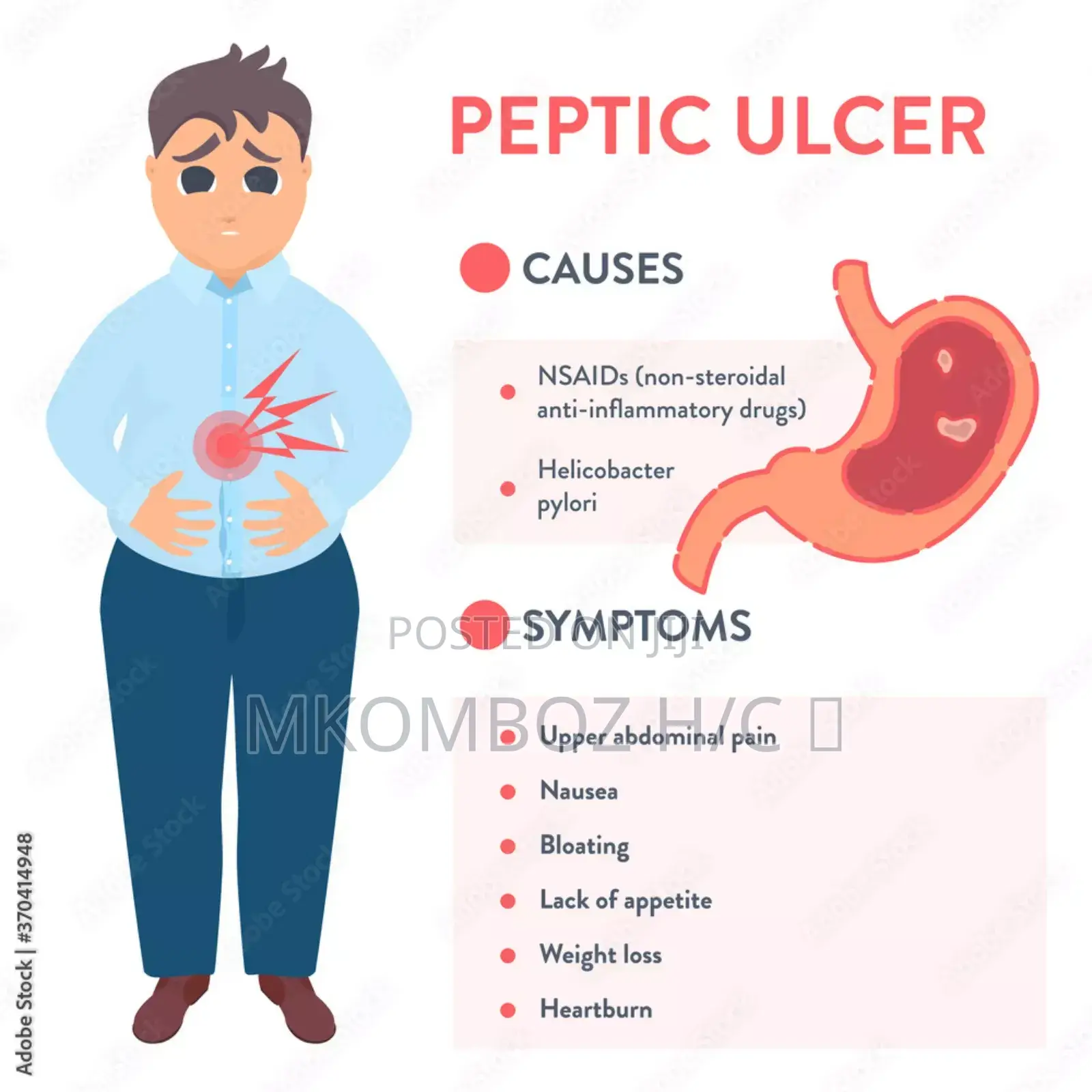Peptic Ulcers Diseases, Tunatibu Na Kumaliza Pud