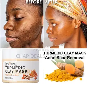 Turmeric Clay Mask