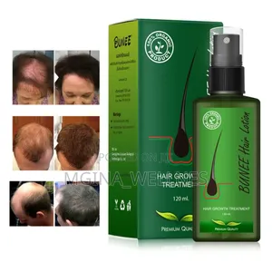 7 Days Neo Hair Lotion for Hair Growth
