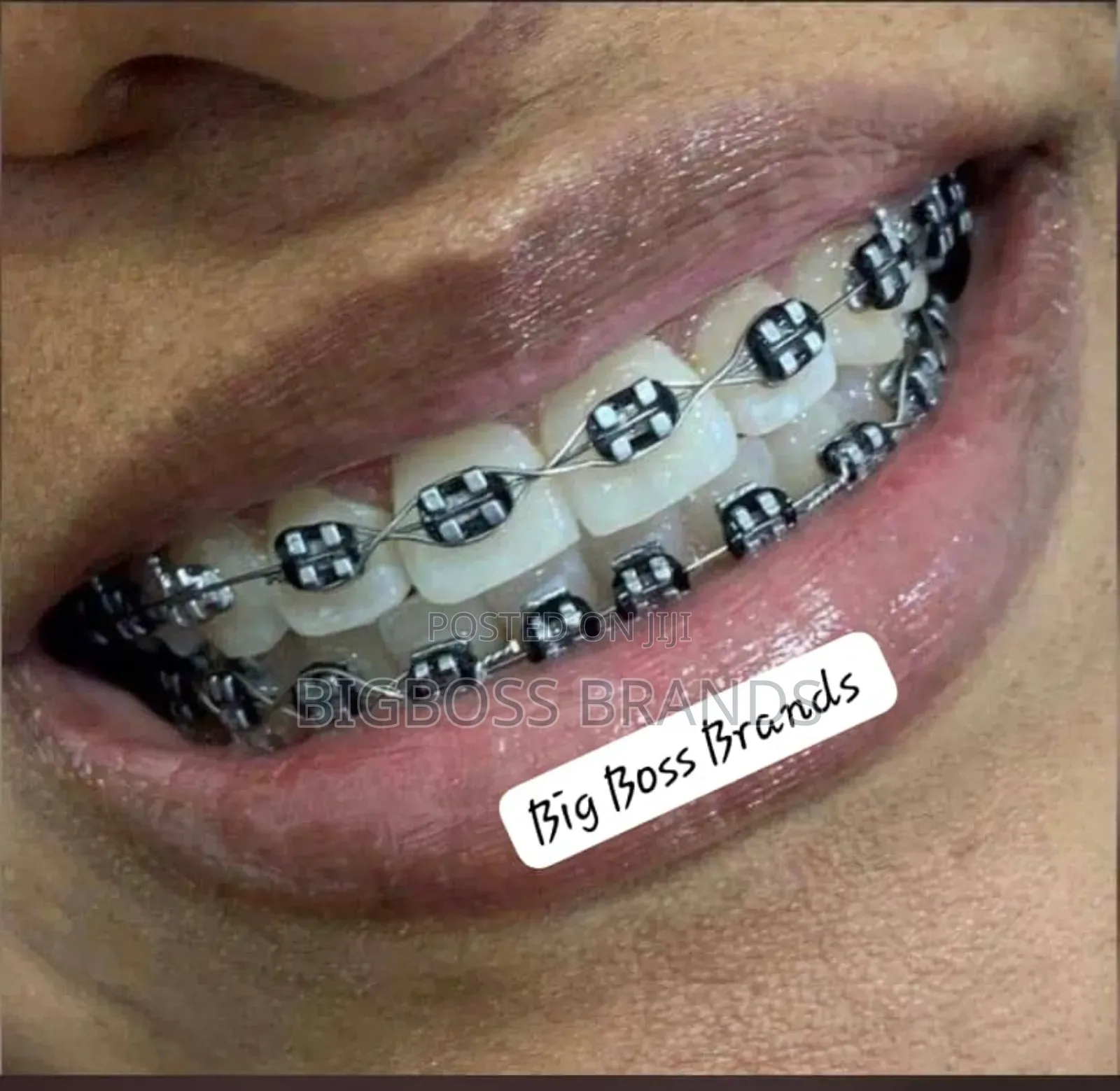 Teeth Bracelets