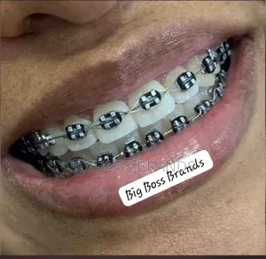 Teeth Bracelets