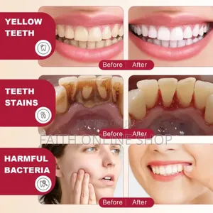 ELAIMEI Probiotic Whitening Toothpaste