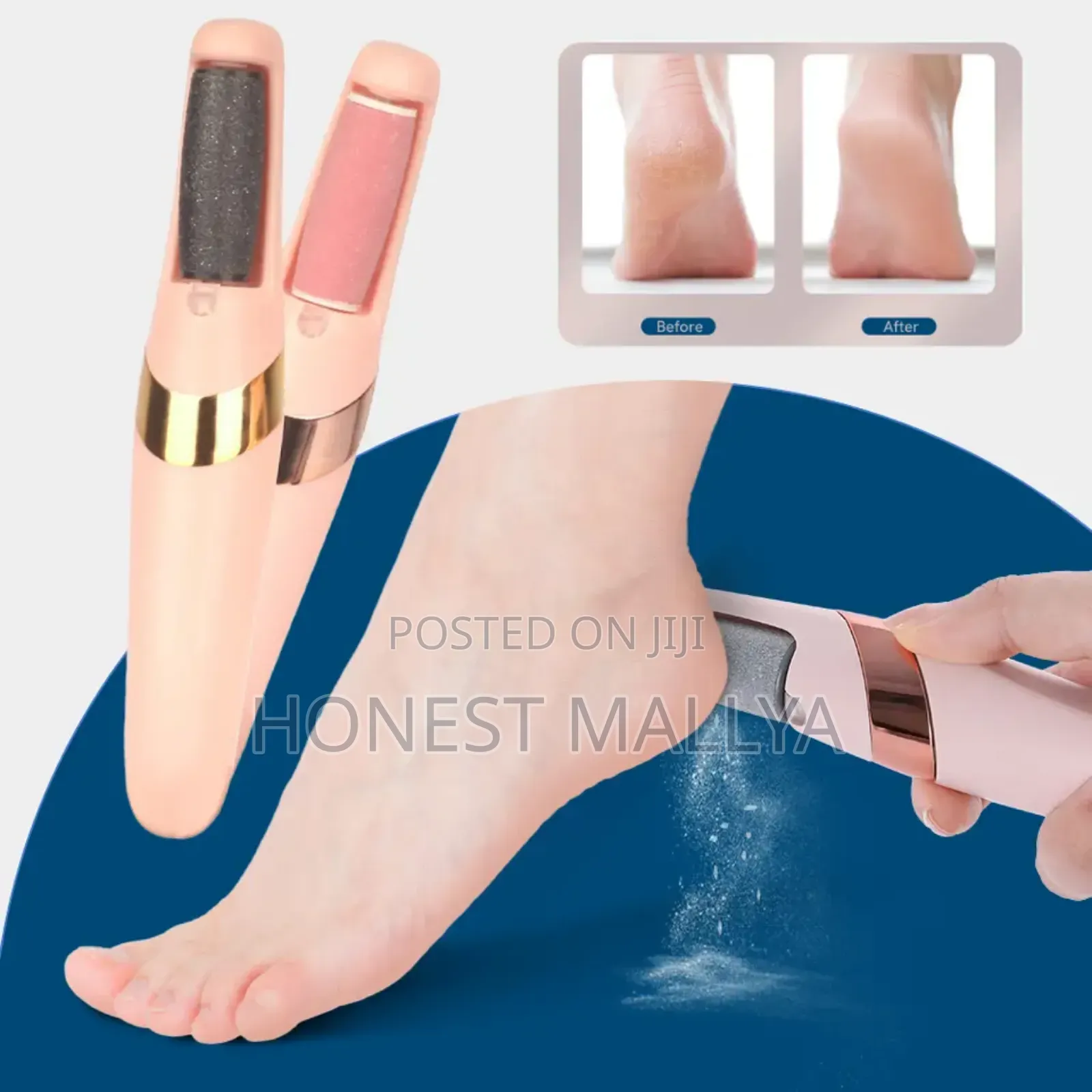 Eletric Callus Remover