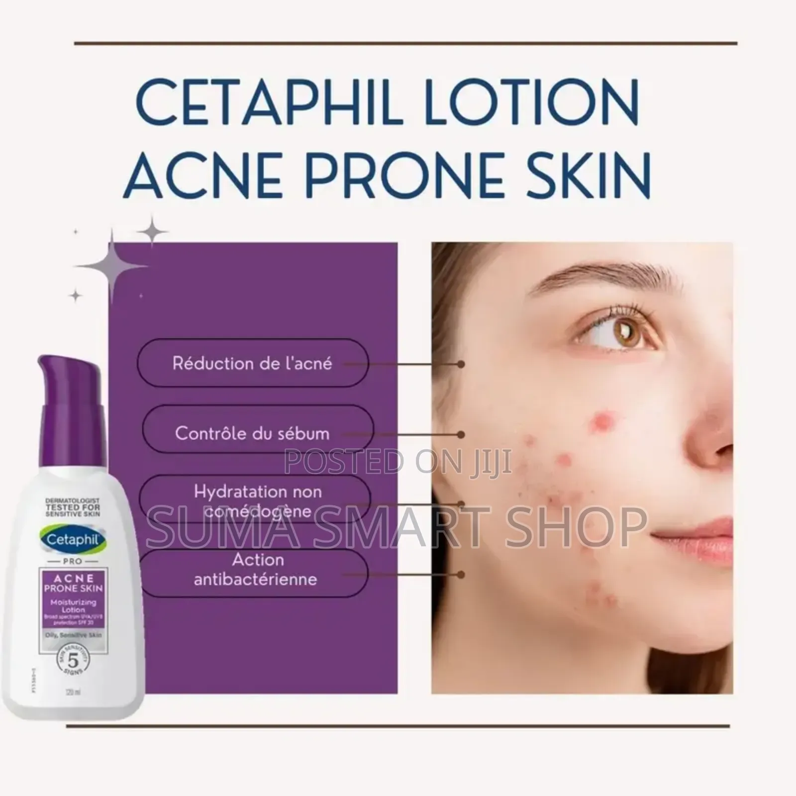 Cetaphil-Pro- Acne Prone Moisturising Lotion .