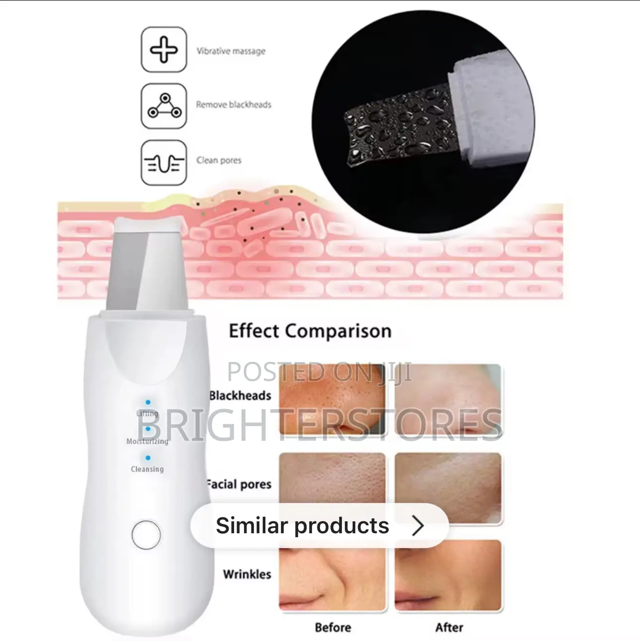 Ultrasound Cleaning Pores