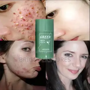 Green Masks for Acnes