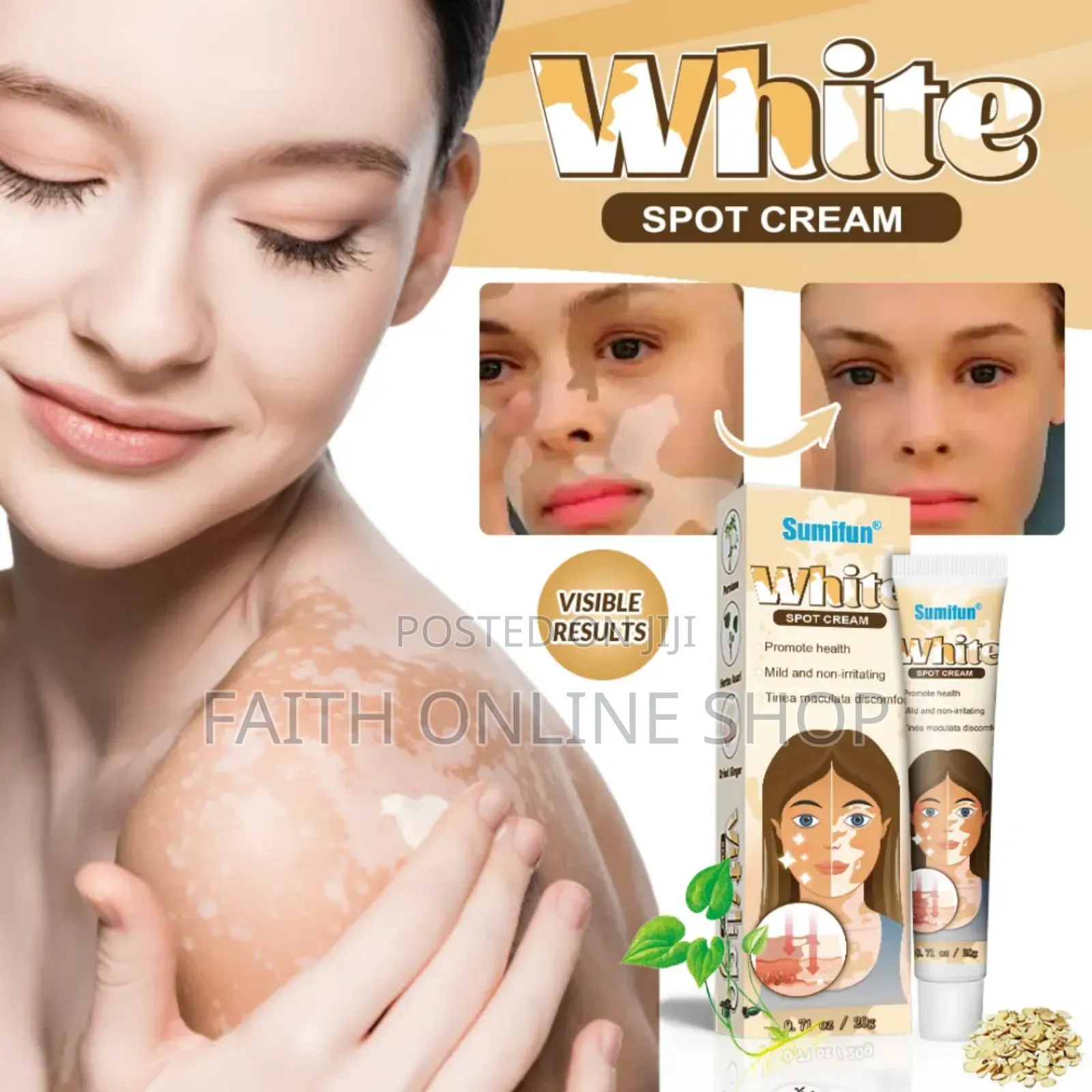 Sumifun Vitiligo Removal Cream 20gm