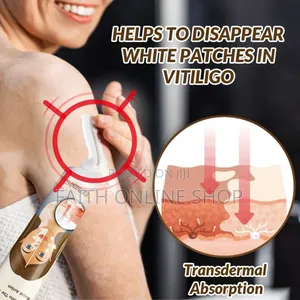 Sumifun Vitiligo Removal Cream 20gm