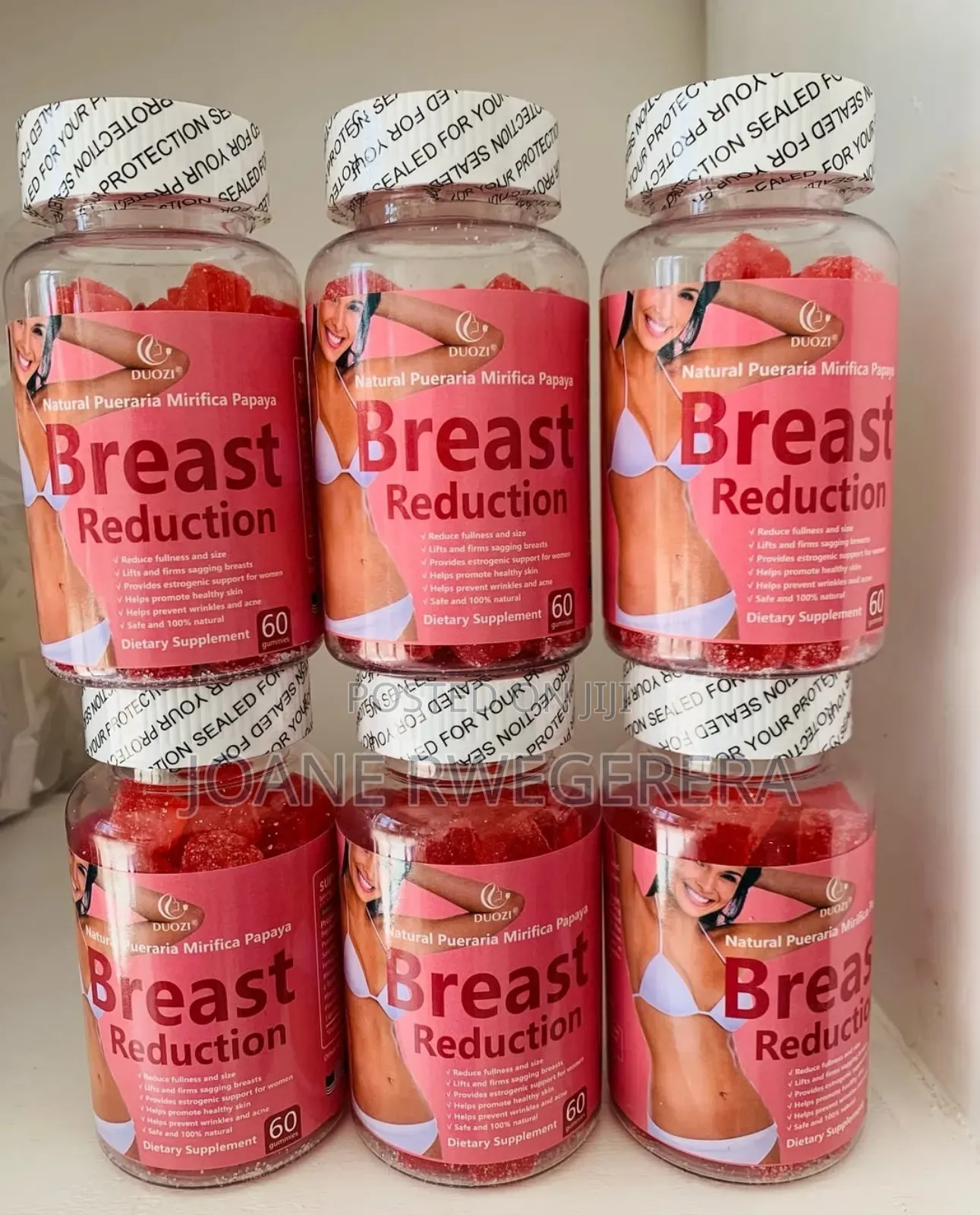 Breast Reduction Supplement