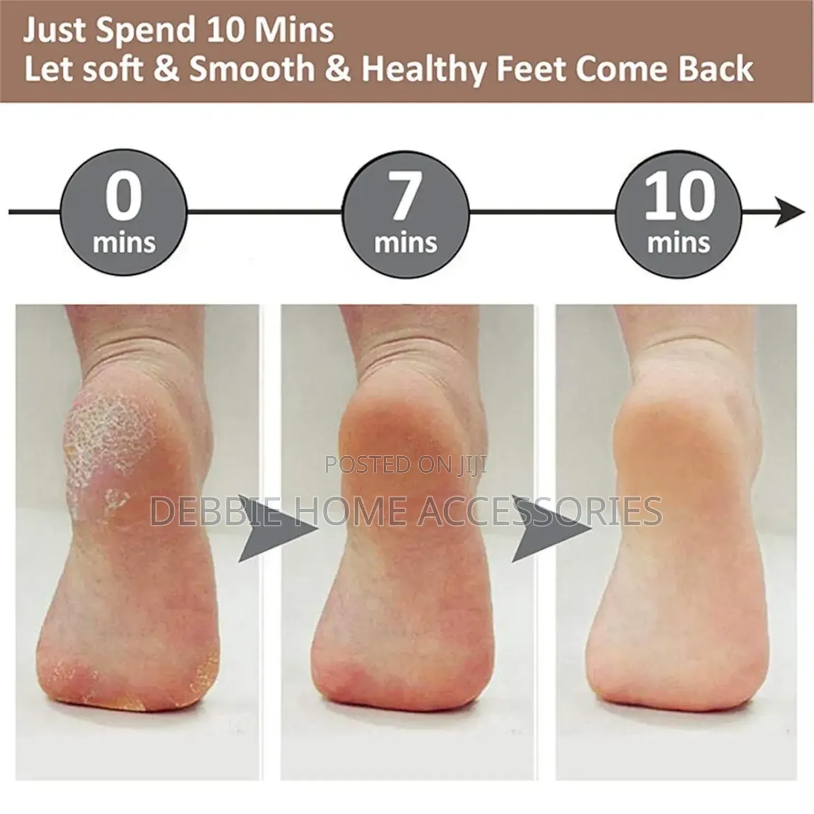 Jianlet Electronic Pedicure Tool.