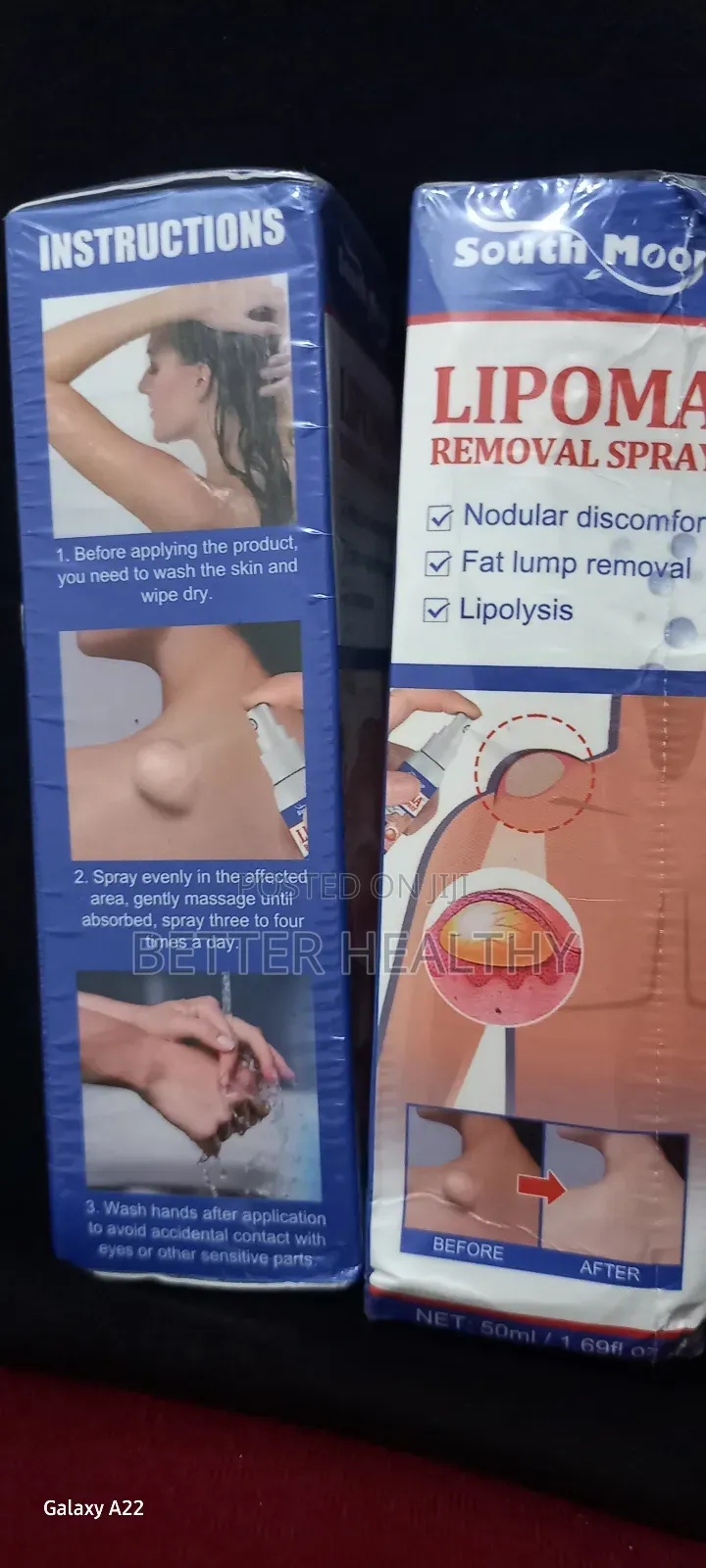 Lipoma Remover