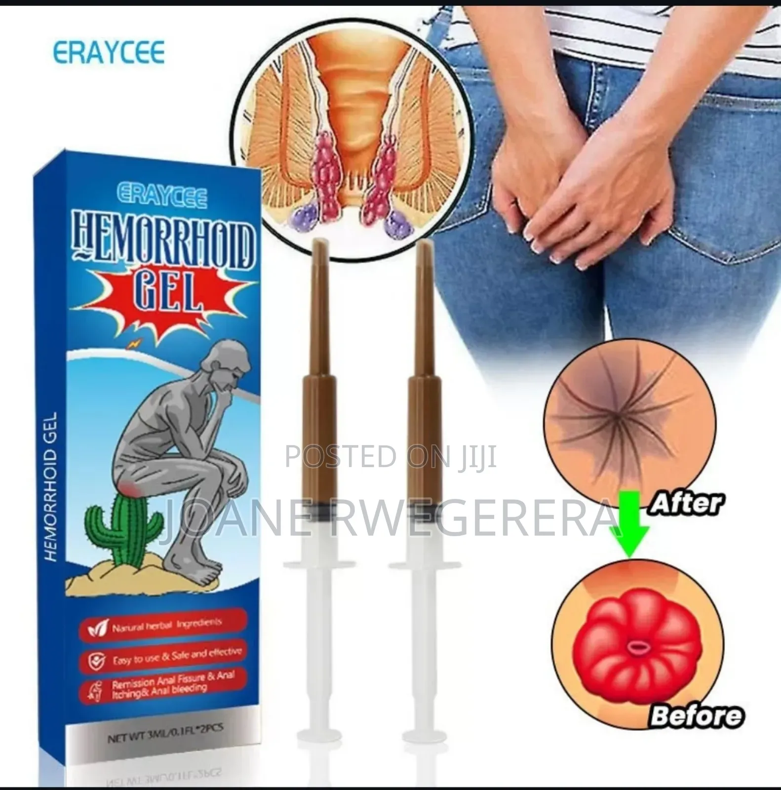 Hemorrhoid Gel