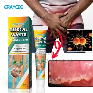 Genital Watts Cream